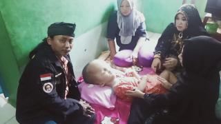 PJBN Donasikan Bantuan Kemanusiaan Pada Ananda Niken Penderita Hidrosefalus Yang Butuh Perhatian 